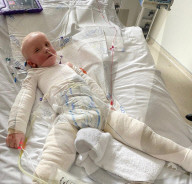 SCHICKSALE - Kinderschicksal: Der kleine Lennon Townsend leidet unter einer schwerwiegenden Hauterkrankung