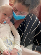 SCHICKSALE - Kinderschicksal: Der kleine Lennon Townsend leidet unter einer schwerwiegenden Hauterkrankung