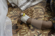 Yemen: in a country stalked by disease, Covid barely registers. War, hunger and devastating aid cuts have made the plight of Yemenis almost unbearable.