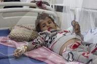 Yemen: in a country stalked by disease, Covid barely registers. War, hunger and devastating aid cuts have made the plight of Yemenis almost unbearable.