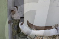 Yemen: in a country stalked by disease, Covid barely registers. War, hunger and devastating aid cuts have made the plight of Yemenis almost unbearable.