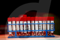 NEWS - Coronavirus:  Grösstes Corona-Testzentrum der Niederlande testet 7000 Personen am Tag