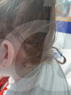 SCHICKSALE - Bei einem routinemässigen Sehtest entdecken Ärzte einen Hirntumor bei der 9-jährigen Maddie