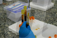 NEWS - Coronavirus: Brasilien - Amazonas startet CovacManaus-Studie