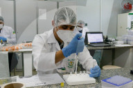 NEWS - Coronavirus: Brasilien - Amazonas startet CovacManaus-Studie