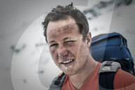 A climber at Everest base camp in Nepal the day after he has successfully summited Everest shows the signs of exposure at high a