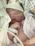 SCHICKSALE - Gigantischen Babybauch: Ärzte vermuteten nicht sichtbaren Zwilling - 5,5 kg schweres Baby zur Welt gebracht