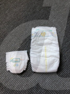 SCHICKSALE - Frühgeborenes Baby überlebt dank Plastiksack