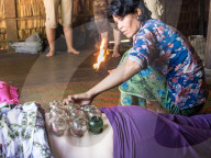 Traditional healing technique of fire cupping, village home near Siem Reap, Cambodia, Southeast Asia