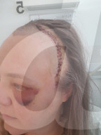 SCHICKSALE - Augenuntersuchung bestätigt einen grossen Tumor im Kopf von Natalie Marriott