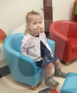 SCHICKSALE - Kara Wedderburn Tochter Evie (3) verliert ihr rechtes Auge wegen eines Retinoplastoms