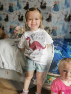 SCHICKSALE - Kara Wedderburn Tochter Evie (3) verliert ihr rechtes Auge wegen eines Retinoplastoms