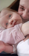 SCHICKSALE - Kara Wedderburn Tochter Evie (3) verliert ihr rechtes Auge wegen eines Retinoplastoms