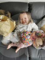 SCHICKSALE - Kara Wedderburn Tochter Evie (3) verliert ihr rechtes Auge wegen eines Retinoplastoms