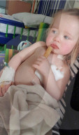 SCHICKSALE - Kara Wedderburn Tochter Evie (3) verliert ihr rechtes Auge wegen eines Retinoplastoms