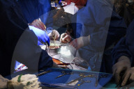 NEWS - Weltweit erste Transplantation eines genetisch veränderten Schweineherzens