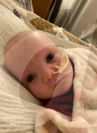 SCHICKSALE - Phoebe Elliotts Tochter Maisie leidet am Galloway-Mowat-Syndrom 6 und kann kaum sehen, essen und sich bewegen
