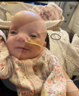 SCHICKSALE - Phoebe Elliotts Tochter Maisie leidet am Galloway-Mowat-Syndrom 6 und kann kaum sehen, essen und sich bewegen