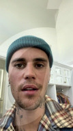 PEOPLE - Bei Justin Bieber ist das Ramsay-Hunt-Syndrom diagnostiziert worden