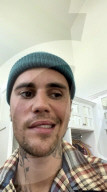 PEOPLE - Bei Justin Bieber ist das Ramsay-Hunt-Syndrom diagnostiziert worden
