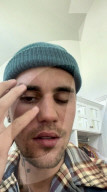 PEOPLE - Bei Justin Bieber ist das Ramsay-Hunt-Syndrom diagnostiziert worden