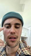 PEOPLE - Bei Justin Bieber ist das Ramsay-Hunt-Syndrom diagnostiziert worden