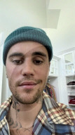PEOPLE - Bei Justin Bieber ist das Ramsay-Hunt-Syndrom diagnostiziert worden