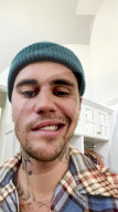 PEOPLE - Bei Justin Bieber ist das Ramsay-Hunt-Syndrom diagnostiziert worden