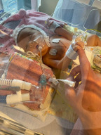 SCHICKSALE - Schwieriger Start ins Leben: Baby Connie musste wenige Stunden nach der Geburt wiederbelebt werden und sich mehreren Operationen unterziehen