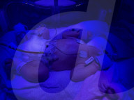 SCHICKSALE - Schwieriger Start ins Leben: Baby Connie musste wenige Stunden nach der Geburt wiederbelebt werden und sich mehreren Operationen unterziehen