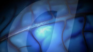 Brain implant for paralysis victims lets them control computers.                    