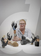 First successful long-term integration of a bionic hand.                        