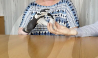 First successful long-term integration of a bionic hand.                        