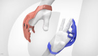 Free to 3D print prosthesis for finger amputees