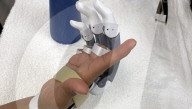 Free to 3D print prosthesis for finger amputees