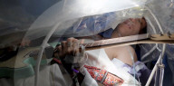 Wide awake guitarist strums his way through brain surgery