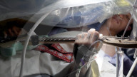 Wide awake guitarist strums his way through brain surgery
