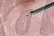 Sticker warns of post surgical problems in patients 