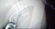 Sticker warns of post surgical problems in patients 