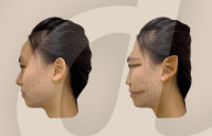 Rare medical condition gives faces demonic-like distortion