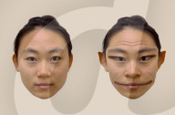 Rare medical condition gives faces demonic-like distortion