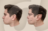 Rare medical condition gives faces demonic-like distortion