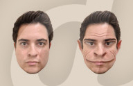 Rare medical condition gives faces demonic-like distortion