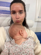 FEATURE - Georgia House, deren Baby Margot mit Masern ins Krankenhaus eingeliefert wurde, bittet die Menschen sich impfen zu lassen