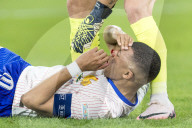 FUSSBALL - EURO 2024: Kylian Mbappe erleidet Nasenbeinbruch
