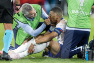 FUSSBALL - EURO 2024: Kylian Mbappe erleidet Nasenbeinbruch