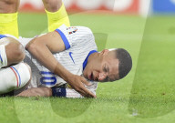 FUSSBALL - EURO 2024: Kylian Mbappe erleidet Nasenbeinbruch