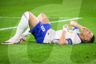 FUSSBALL - EURO 2024: Kylian Mbappe erleidet Nasenbeinbruch