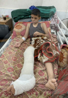 Wounded Gaza children in hospital