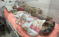 Wounded Gaza children in hospital